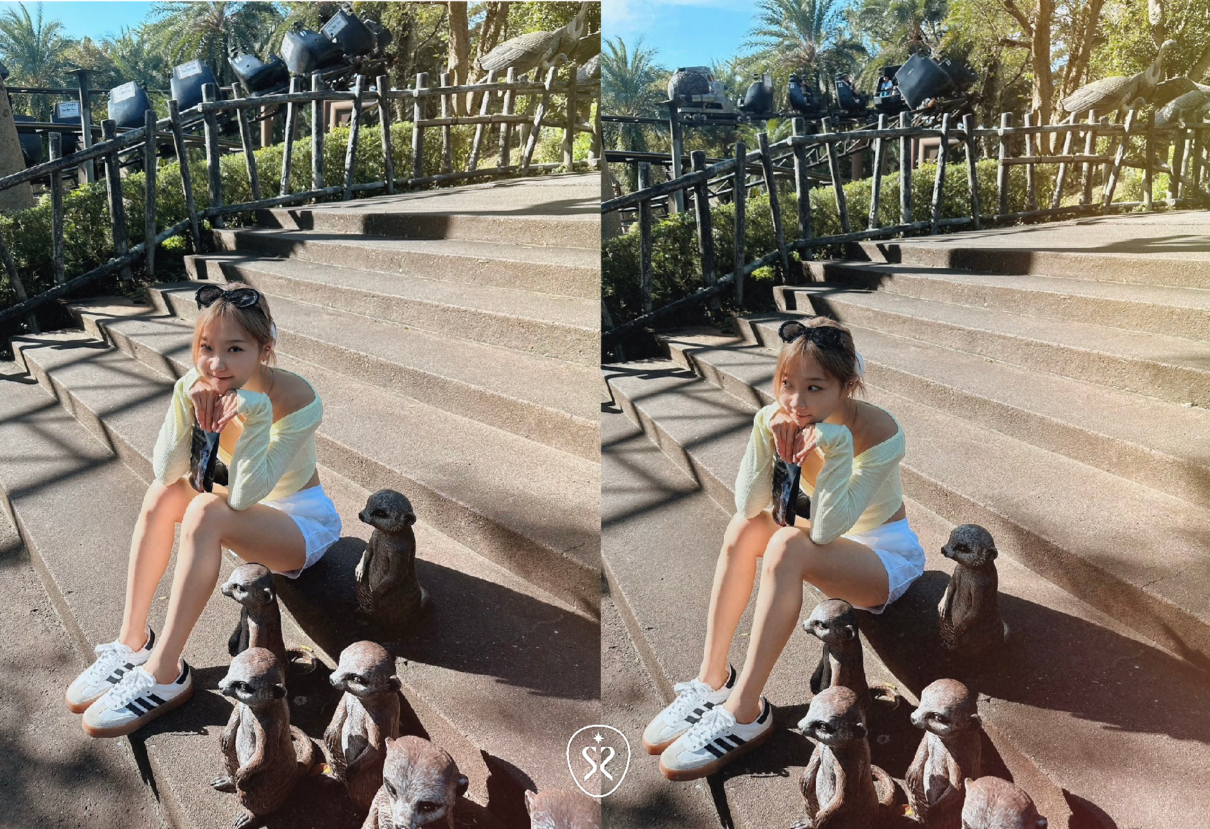 自強星和診所竹北-Dysport肉毒小腿纖細成果